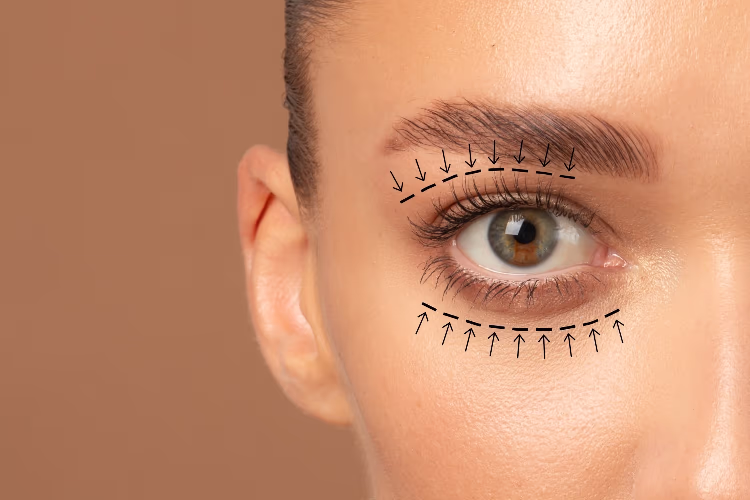 Oculoplastic Surgery Risks