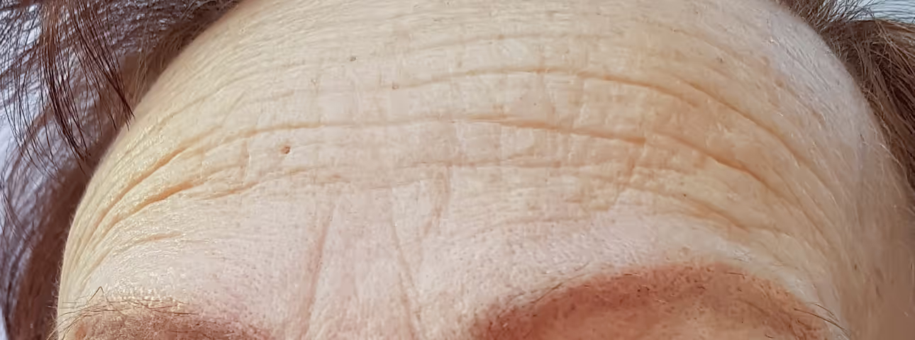 Close-up of aging skin on forehead